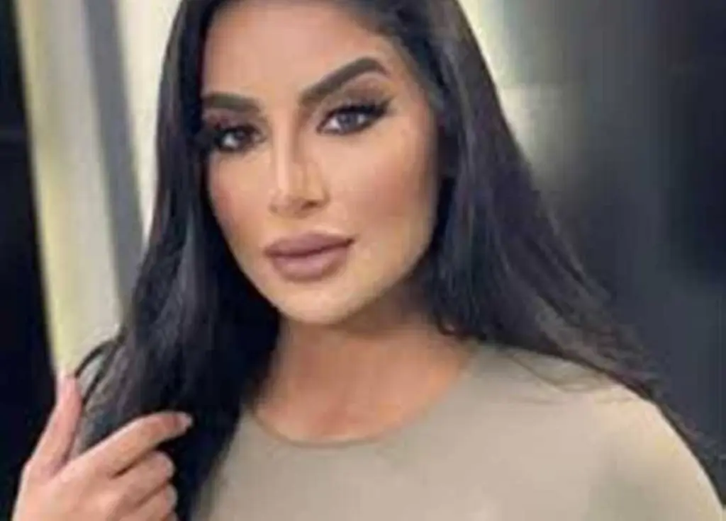 نجاة الفنانة المصرية جوري بكر من حادث سير إثر إنفجار إطار سيارتها